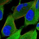 KLHL41 Polyclonal Antibody