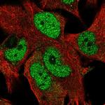 ZN827 Polyclonal Antibody