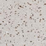 ZN827 Antibody in Immunohistochemistry (Paraffin) (IHC (P))