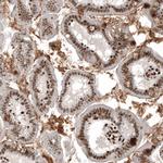 ZN827 Antibody in Immunohistochemistry (Paraffin) (IHC (P))