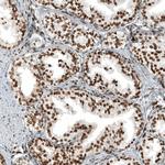 ZN827 Antibody in Immunohistochemistry (Paraffin) (IHC (P))