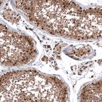 ZN827 Antibody in Immunohistochemistry (Paraffin) (IHC (P))