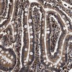 ZNF313 Antibody in Immunohistochemistry (Paraffin) (IHC (P))