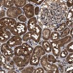 ZNF313 Antibody in Immunohistochemistry (Paraffin) (IHC (P))