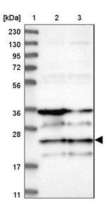 ZNF313 Antibody in Western Blot (WB)