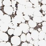 ZNF687 Polyclonal Antibody