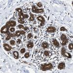 ZNF614 Antibody in Immunohistochemistry (Paraffin) (IHC (P))