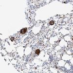 AJM1 Antibody in Immunohistochemistry (Paraffin) (IHC (P))