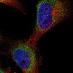 TRUB2 Polyclonal Antibody