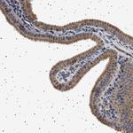 TRUB2 Antibody in Immunohistochemistry (Paraffin) (IHC (P))