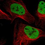 SMARCC2 Polyclonal Antibody