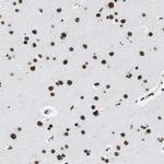 SMARCC2 Antibody in Immunohistochemistry (Paraffin) (IHC (P))
