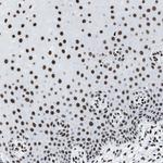 SMARCC2 Antibody in Immunohistochemistry (Paraffin) (IHC (P))