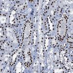 SMARCC2 Antibody in Immunohistochemistry (Paraffin) (IHC (P))