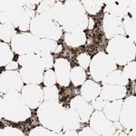 C9orf78 Antibody in Immunohistochemistry (IHC)