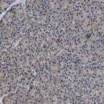 C9orf78 Antibody in Immunohistochemistry (IHC)