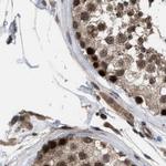 C9orf78 Antibody in Immunohistochemistry (IHC)