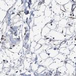 PTRH1 Polyclonal Antibody