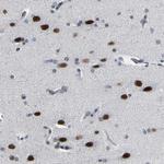 FAM180A Polyclonal Antibody