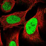 C9orf78 Polyclonal Antibody