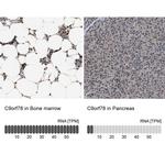 C9orf78 Antibody in Immunohistochemistry (IHC)