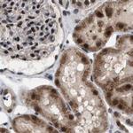 C9orf78 Antibody in Immunohistochemistry (IHC)