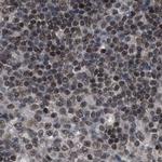 C9orf78 Antibody in Immunohistochemistry (IHC)