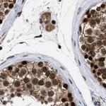 C9orf78 Antibody in Immunohistochemistry (IHC)