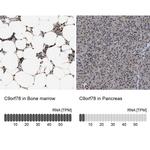 C9orf78 Antibody