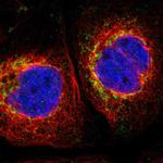 MRPL10 Polyclonal Antibody