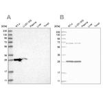MRPL10 Antibody in Western Blot (WB)