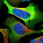 PHGDH Polyclonal Antibody