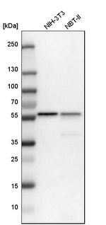 PHGDH Antibody in Western Blot (WB)