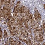 PHGDH Antibody in Immunohistochemistry (IHC)