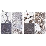 C9orf78 Antibody in Immunohistochemistry (IHC)