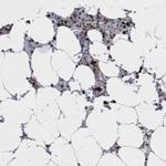 C9orf78 Antibody in Immunohistochemistry (IHC)