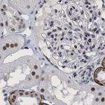 C9orf78 Antibody in Immunohistochemistry (IHC)