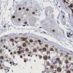 C9orf78 Antibody in Immunohistochemistry (IHC)
