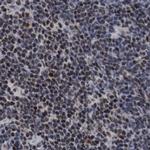 C9orf78 Antibody in Immunohistochemistry (IHC)