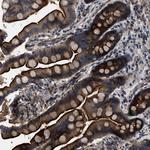 PTAR1 Antibody in Immunohistochemistry (Paraffin) (IHC (P))