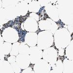 MYO1G Antibody in Immunohistochemistry (IHC)