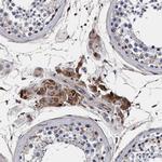 RNF208 Antibody in Immunohistochemistry (Paraffin) (IHC (P))