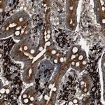 BAIAP2L1 Antibody in Immunohistochemistry (IHC)