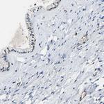 DPP2 Antibody in Immunohistochemistry (Paraffin) (IHC (P))