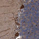 BBS9 Polyclonal Antibody