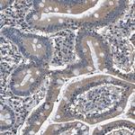 AAED1 Antibody in Immunohistochemistry (Paraffin) (IHC (P))