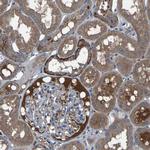 AAED1 Antibody in Immunohistochemistry (Paraffin) (IHC (P))