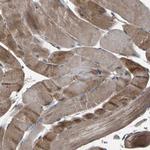 AAED1 Polyclonal Antibody