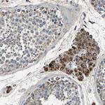 AAED1 Antibody in Immunohistochemistry (Paraffin) (IHC (P))