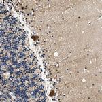 SAMD9 Antibody in Immunohistochemistry (Paraffin) (IHC (P))